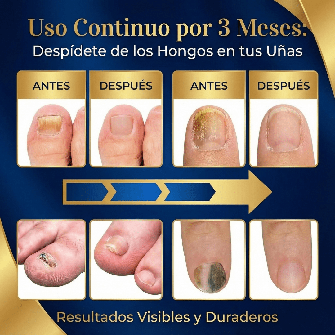 Los hongos NO desaparecen tapándolos. Usa esta lampara directo sobre la uña y empieza a notar el cambio.