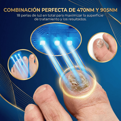 Los hongos NO desaparecen tapándolos. Usa esta lampara directo sobre la uña y empieza a notar el cambio.